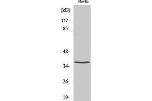 Western Blot analysis of various cells using TNF-IP 1 Polyclonal Antibody diluted at 1:500. (TNFAIP1 antibody  (AA 40-120))