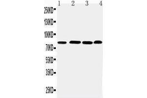 Anti-PROX1 antibody, Western blotting Lane 1: Rat Thymus Tissue Lysate Lane 2: HELA Cell Lysate Lane 3: JURKAT Cell Lysate Lane 4: MM231 Cell Lysate (PROX1 antibody  (Middle Region))