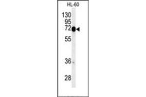 Western blot analysis of Complex IV subunit I Antibody  in HL-60 cell line lysates (35ug/lane). (Complex IV Subunit I (AA 202-232), (Middle Region) antibody)