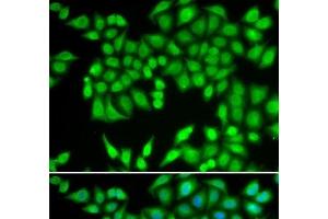 Immunofluorescence analysis of U2OS cells using MCM3 Polyclonal Antibody (MCM3 antibody)