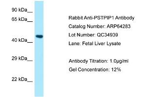 Western Blotting (WB) image for anti-Proline-serine-threonine Phosphatase Interacting Protein 1 (PSTPIP1) (N-Term) antibody (ABIN971496) (PSTPIP1 antibody  (N-Term))