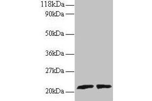 Western blot All lanes: ARL2 antibody at 2 μg/mL Lane 1: EC109 whole cell lysate Lane 2: 293T whole cell lysate Secondary Goat polyclonal to rabbit IgG at 1/15000 dilution Predicted band size: 21, 19 kDa Observed band size: 21 kDa (ARL2 antibody  (AA 19-184))