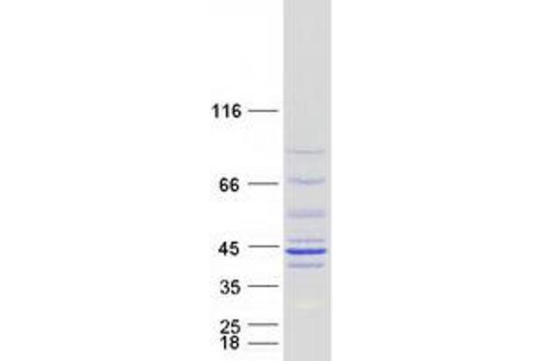 NDUFAF1 Protein (Myc-DYKDDDDK Tag)