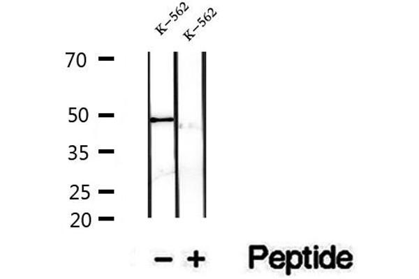 FECH antibody  (C-Term)