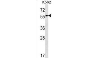 Western Blotting (WB) image for anti-Retinoic Acid Receptor, beta (RARB) antibody (ABIN2999994) (Retinoic Acid Receptor beta antibody)