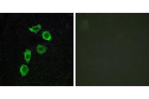 Peptide - +Immunofluorescence analysis of HuvEc cells, using GPR123 antibody. (GPR123 antibody  (Internal Region))