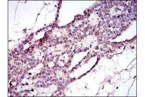 Immunohistochemistry (IHC) image for anti-Piwi-Like 4 (PIWIL4) (AA 304-434) antibody (ABIN1724793)