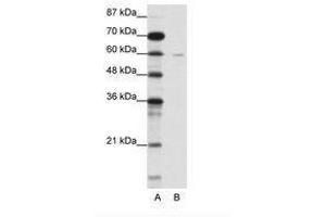 Image no. 1 for anti-DCP1 Decapping Enzyme Homolog A (S. Cerevisiae) (DCP1A) (N-Term) antibody (ABIN202698) (DCP1A antibody  (N-Term))