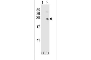 Western blot analysis of HPRT1 using rabbit polyclonal HPRT1 Antibody using 293 cell lysates (2 ug/lane) either nontransfected (Lane 1) or transiently transfected (Lane 2) with the HPRT1 gene. (HPRT1 antibody  (C-Term))