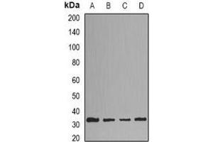 Western blot analysis of HNMT expression in HepG2 (A), Hela (B), mouse liver (C), mouse brain (D) whole cell lysates. (HNMT antibody)