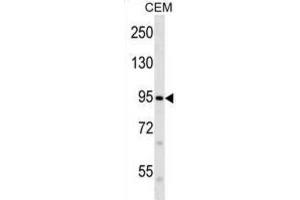 Western Blotting (WB) image for anti-Family with Sequence Similarity 38, Member B (FAM38B) antibody (ABIN2998661) (PIEZO2 antibody)