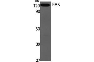 Western Blotting (WB) image for anti-PTK2 Protein tyrosine Kinase 2 (PTK2) (Tyr576) antibody (ABIN5960992) (FAK antibody  (Tyr576))