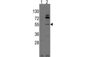 Western Blotting (WB) image for anti-Cdc42 Guanine Nucleotide Exchange Factor (GEF) 9 (Arhgef9) antibody (ABIN3001570) (Arhgef9 antibody)