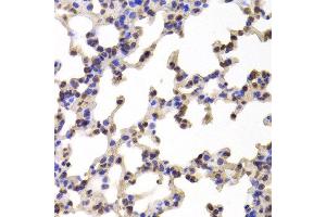 Immunohistochemistry of paraffin-embedded Mouse lung using C1R antibody at dilution of 1:100 (x400 lens). (C1R antibody)