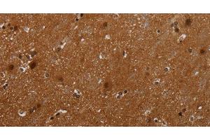 Immunohistochemistry of paraffin-embedded Human brain tissue using MAGEB18 Polyclonal Antibody at dilution 1:30 (MAGEB18 antibody)