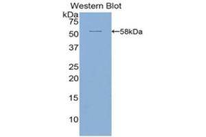 Western Blotting (WB) image for anti-Activated Leukocyte Cell Adhesion Molecule (ALCAM) (AA 28-527) antibody (ABIN1857959) (CD166 antibody  (AA 28-527))