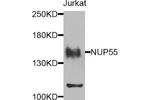 Western blot analysis of extracts of Jurkat cells, using NUP155 antibody. (NUP155 antibody)