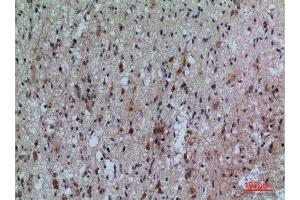 Immunohistochemistry (IHC) analysis of paraffin-embedded Human Brain, antibody was diluted at 1:100. (FCRL5 antibody  (Internal Region))