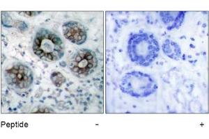 Image no. 1 for anti-Growth Associated Protein 43 (GAP43) (Ser41) antibody (ABIN197546) (GAP43 antibody  (Ser41))