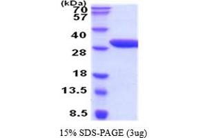 SDS-PAGE (SDS) image for Erythropoietin Receptor (EPOR) (AA 25-250) protein (His tag) (ABIN5854452) (EPOR Protein (AA 25-250) (His tag))