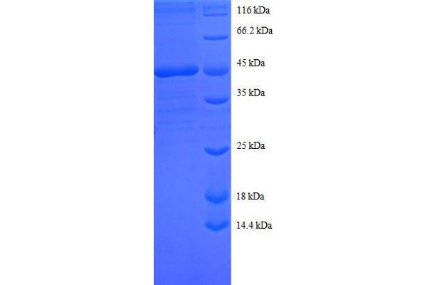 Sorting Nexin 3 Protein (SNX3) (AA 3-162, full length) (GST tag)