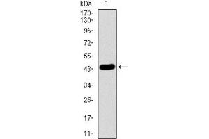 Western Blotting (WB) image for anti-LIM Domain Only 2 (Rhombotin-Like 1) (LMO2) (AA 1-158) antibody (ABIN1844241) (LMO2 antibody  (AA 1-158))