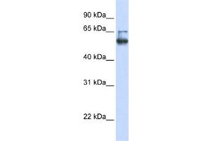 WB Suggested Anti-LENG4 Antibody Titration:  0. (MBOAT7 antibody  (C-Term))