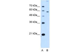 SLC22A2 antibody used at 2. (SLC22A2 antibody)