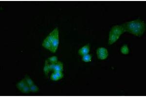 Immunofluorescent analysis of PC-3 cells using ABIN7149984 at dilution of 1:100 and Alexa Fluor 488-congugated AffiniPure Goat Anti-Rabbit IgG(H+L) (DPP4 antibody  (AA 473-588))