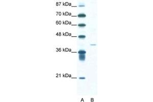 Western Blotting (WB) image for anti-Hypoxia Inducible Factor 1, alpha Subunit Inhibitor (HIF1AN) antibody (ABIN2460605) (HIF1AN antibody)