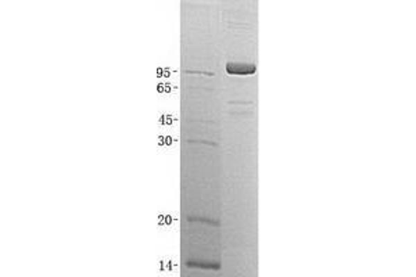 XPNPEP1 Protein (Transcript Variant 2) (His tag)