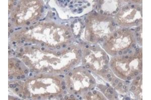 DAB staining on IHC-P; Samples: Human Kidney Tissue (PTTG1IP antibody  (AA 33-96))