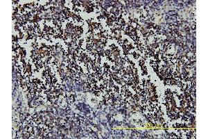 Immunoperoxidase of monoclonal antibody to RARA on formalin-fixed paraffin-embedded human lymph node tissue. (Retinoic Acid Receptor alpha antibody  (AA 1-462))