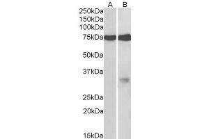Western Blotting (WB) image for anti-Glycoprotein M6A (GPM6A) antibody (ABIN5923481) (GPM6A antibody)