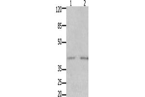 Western Blotting (WB) image for anti-GDNF Family Receptor alpha 3 (GFRA3) antibody (ABIN2425985) (GFRA3 antibody)