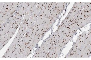 ABIN6267591 at 1/200 staining human Smooth muscle tissue sections by IHC-P. (MEF2A antibody  (pThr319))