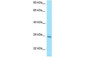 WB Suggested Anti-Eif3k Antibody Titration: 1. (EIF3K antibody  (N-Term))