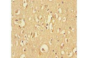Immunohistochemistry of paraffin-embedded human brain tissue using ABIN7167749 at dilution of 1:100 (RTN4RL1 antibody  (AA 201-420))