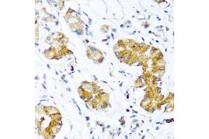 Immunohistochemistry of paraffin-embedded human stomach using WFDC2 antibody at dilution of 1:100 (40x lens). (WFDC2 antibody)