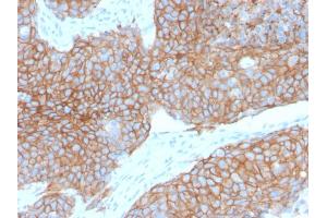 Formalin-fixed, paraffin-embedded human Cervix stained with E-Cadherin Rabbit Recombinant Monoclonal Antibody (CDH1/2208R). (Recombinant E-cadherin antibody)