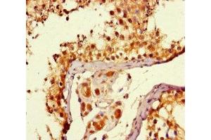 Immunohistochemistry of paraffin-embedded human testis tissue using ABIN7169076 at dilution of 1:100 (MTOR antibody  (AA 1223-1290))