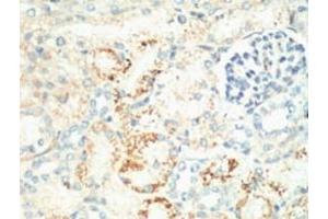IHC staining of Mouse Kidney tissue, diluted at 1:200. (Ki-67 antibody)