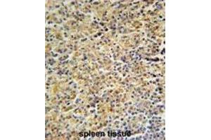 Immunohistochemistry (IHC) image for anti-Hemopoietic Cell Kinase (HCK) antibody (ABIN3003448) (HCK antibody)