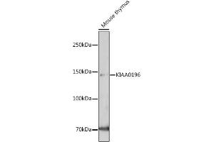 Western blot analysis of extracts of Mouse thymus, using KI antibody (ABIN7271349) at 1:1000 dilution. (Strumpellin antibody  (AA 380-530))