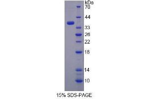 SDS-PAGE analysis of Human TST Protein. (TST Protein)