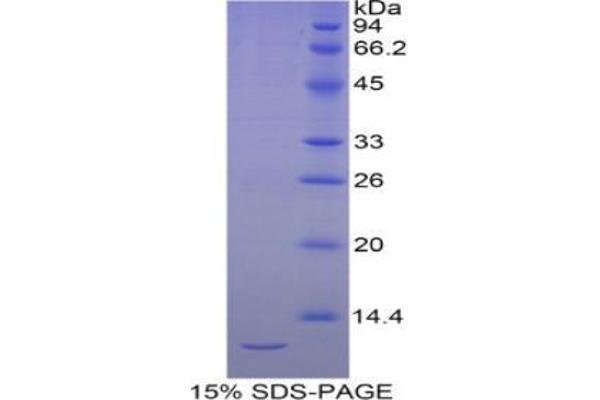 Selenoprotein W Protein