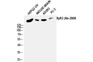 Western Blotting (WB) image for anti-Ryanodine Receptor 2 (Cardiac) (RYR2) (Ser2808) antibody (ABIN5957596) (RYR2 antibody  (Ser2808))