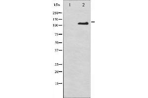 Western blot analysis of Integrin beta3 phosphorylation expression in Insulin treated 293 whole cell lysates,The lane on the left is treated with the antigen-specific peptide. (Integrin beta 3 antibody  (pTyr785))