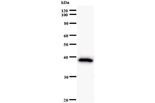 ARID2 antibody