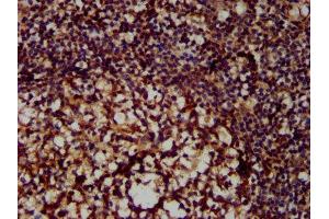 IHC image of ABIN7156645 diluted at 1:300 and staining in paraffin-embedded human tonsil tissue performed on a Leica BondTM system. (MX2 antibody  (AA 548-688))